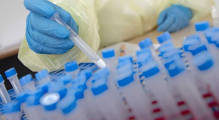 Große Corona-Testaktion am Frankfurter Flughafen Frankfurter Flughafen: Personal von Chemlab bearbeitet die Tests direkt vor Ort